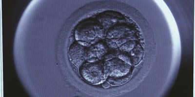 In Vitro Fertilisation (IVF) with donor sperm image
