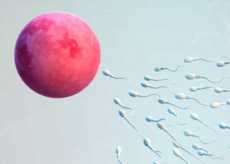 Intra-Uterine Insemination image